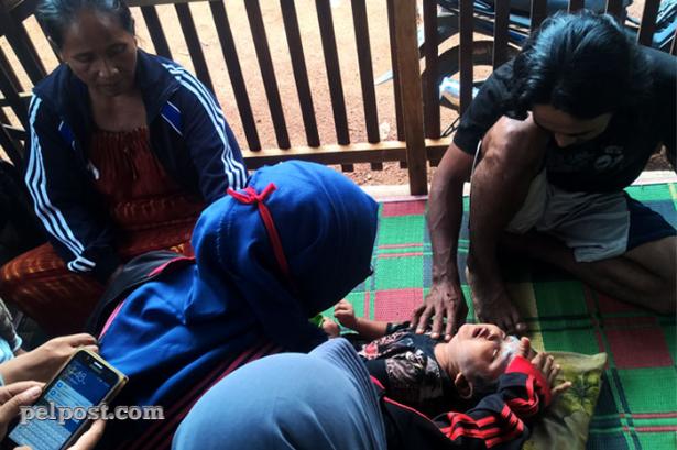Tak Tahan Mendengar Ledakan Petasan, Membuat Anak ini Lumpuh Sejak Kecil